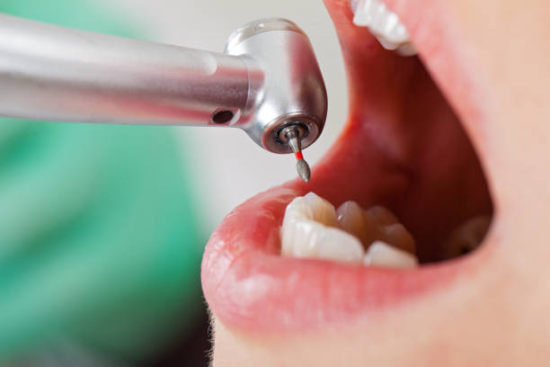 Best Emergency Treatment for Toothache in Fairland, MD